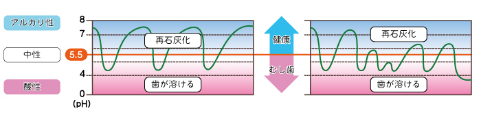 再石灰化.jpg